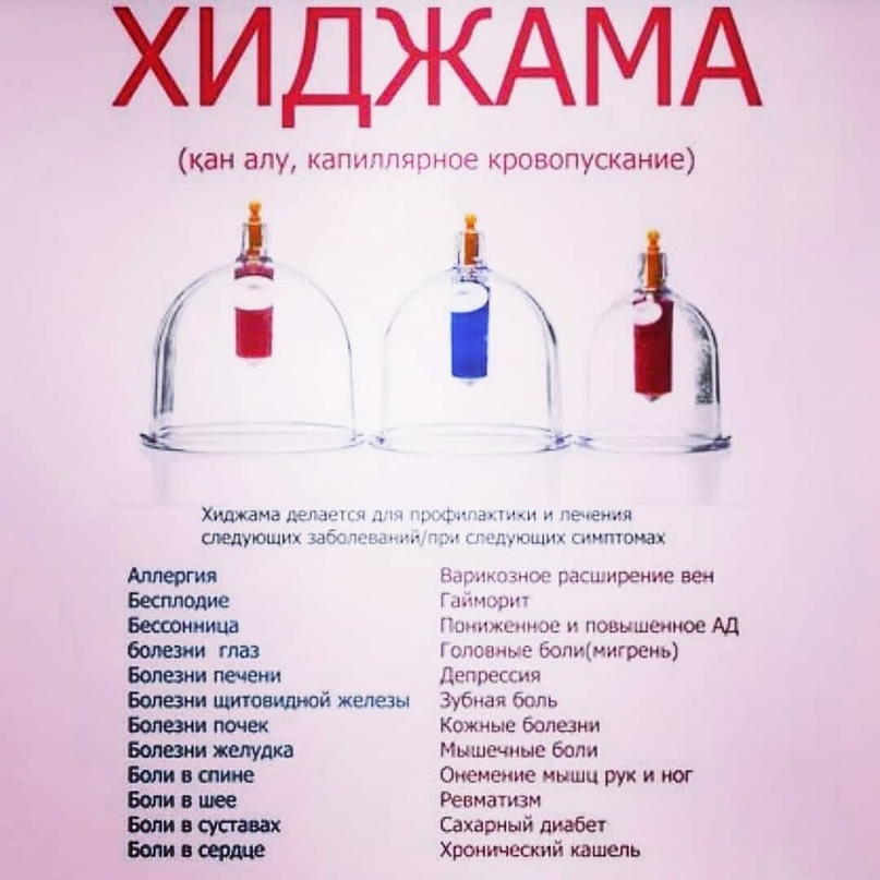 Уникальная техника Хиджама с Танзилёй Хасановой у нас в центре